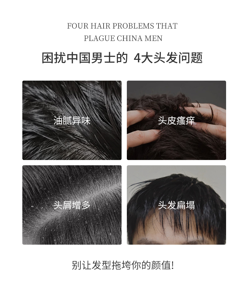 困擾中國男士的四大問題，油膩異味、頭皮瘙癢、頭屑增多、頭發(fā)扁塌